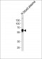 SERPINA1 Antibody (Center)