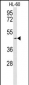 SLC1A5 Antibody (Center)