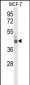 ELF3 Antibody (C-term)