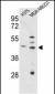 CTSD Antibody (C-term)