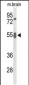 GRB7 Antibody (Center)