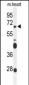 FZD4 Antibody (C-term)