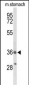 BRS3 Antibody (Center)