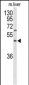 GPR160 Antibody (C-term)