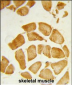 ANP32A Antibody (C-term)