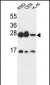 ANP32A Antibody (C-term)
