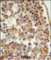 FANCC Antibody (C-term)