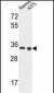 LDHA Antibody (Center)