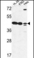 LFNG Antibody (Center)