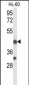 TNFRSF10D Antibody (Center)