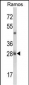 NUCKS1 Antibody (N-term)