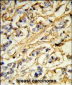 CHMP4B Antibody (N-term)
