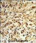 MAT2B Antibody (N-term)