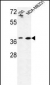 MAT2B Antibody (N-term)