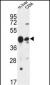 PLA1A Antibody (Center)