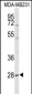 YIPF5 Antibody (N-term)