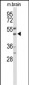 WIPI2 Antibody (C-term)