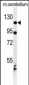 KIF6 Antibody (N-term)