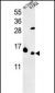 RPL37 Antibody (C-term)