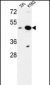 NUPL2 Antibody (N-term)