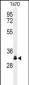 DKK1 Antibody (N-term)