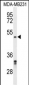 CBX2 Antibody (N-term)