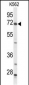 ACSS2 Antibody (N-term)