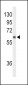 SLCO1B1 Antibody (Center)