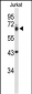 TLE1 Antibody (Center)