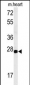 CLDN4 Antibody (C-term)