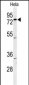 CLPTM1 Antibody (Center)