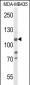 JMJD2B Antibody (T305)