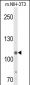 JMJD2B Antibody (T305)