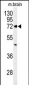 ABCD2 Antibody (Center)