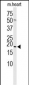 HSPB6 Antibody (Center)