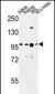 BCL11A Antibody (C-term)
