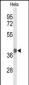 PDHA1 Antibody (Center)