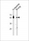 CREB3L2 Antibody (C-term)