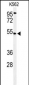 CBAA1 Antibody (N-term)