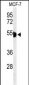 KRT1 Antibody (Center)