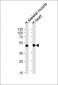 HFE2 Antibody (Center)