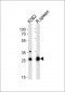 SLC25A37 Antibody (C-term)