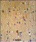 ZDHHC9 Antibody (C-term)