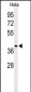 ADPRHL2 Antibody (N-term)