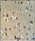 UPK1B Antibody (Center)
