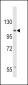 AP9739b-CACNA2D3-Antibody-C-term