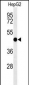 SGMS2 Antibody (C-term)