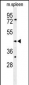 SGMS2 Antibody (C-term)