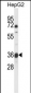 MOSC1 Antibody (Center)