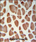 HSD11B2 Antibody (Center)